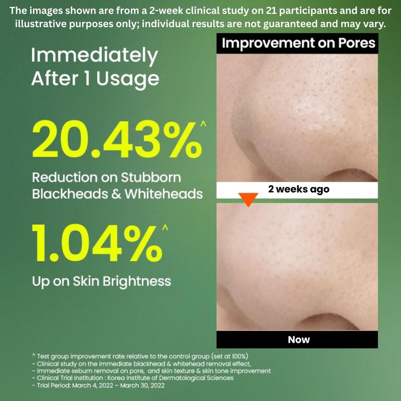 Skin Detox Cleansing Kit – Mung Bean Oil + Foam Cleanser + Peeling Gel + Clay Mask